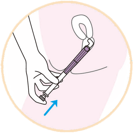 ②ピストンの先端からスポンジを膣内に押し出します